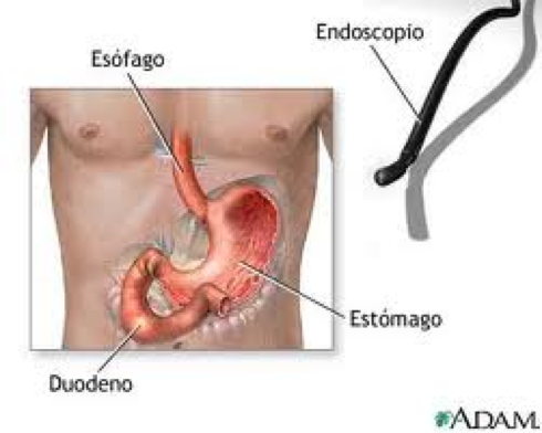 Como funciona a endoscopia